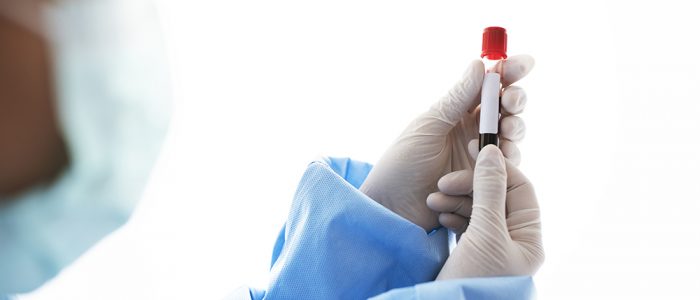 Doctor holding a blood test tube